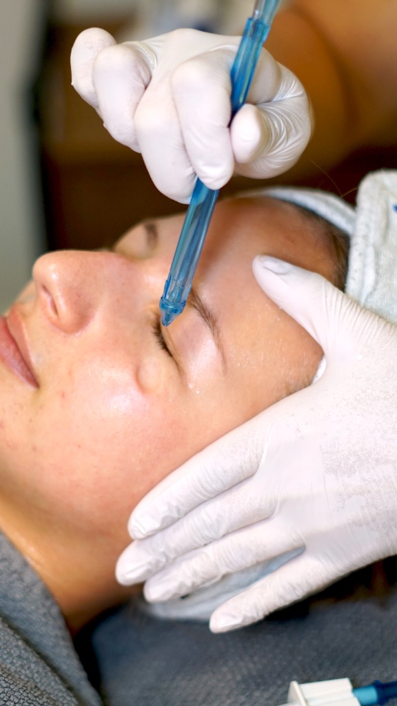 Facial treatment close-up